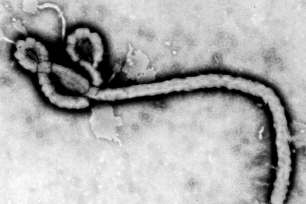 ebola sintomas 1 xd9Qxh
