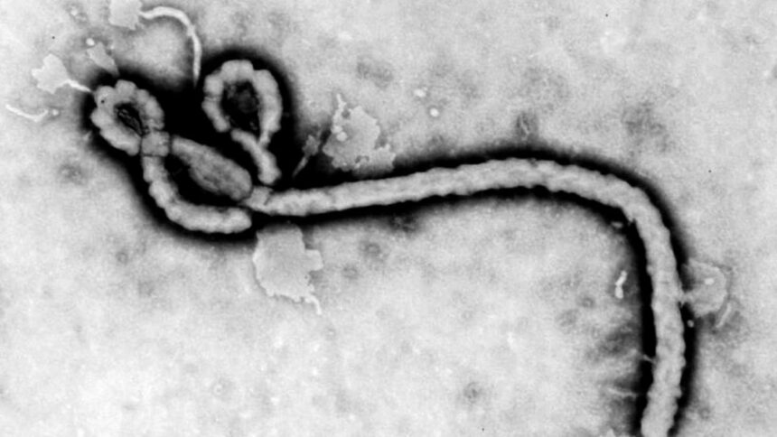ebola sintomas 1 xd9Qxh